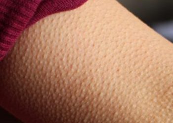If Music Gives You Goosebumps, Here’s What It May Say About Your Brain