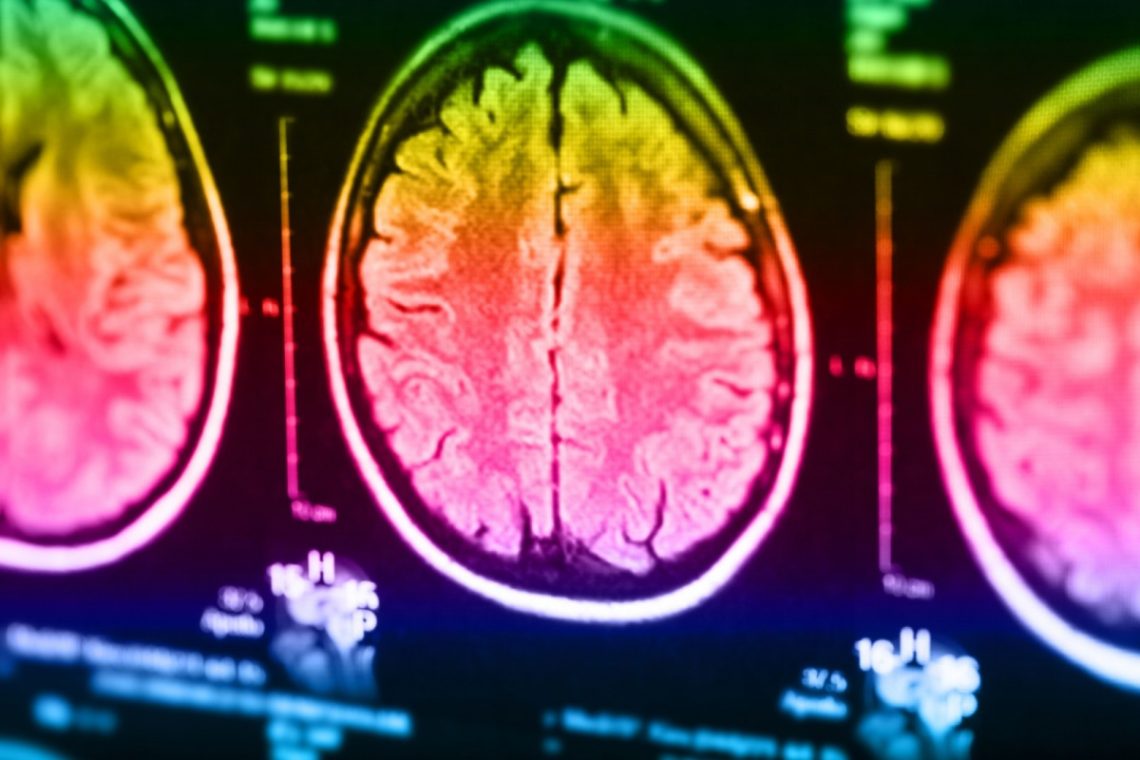 Researchers Use MRI Technology To Try & Demonstrate Telepathy Between Humans