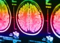 Researchers Use MRI Technology To Try & Demonstrate Telepathy Between Humans