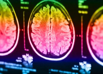Researchers Use MRI Technology To Try & Demonstrate Telepathy Between Humans