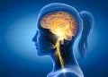 My Experience with Vagus Nerve Stimulation